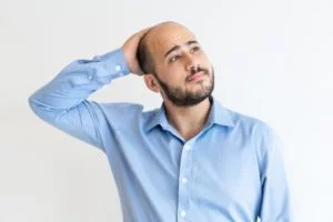 É possível tratar a calvície sem medicamentos e ter um resultado positivo?